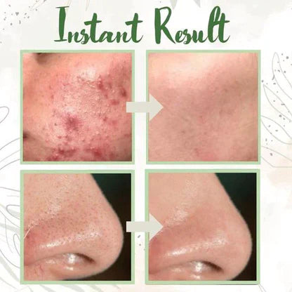 Final Sale - Green TeaDeep Cleanse Mask -(Limited time discount🔥last day)