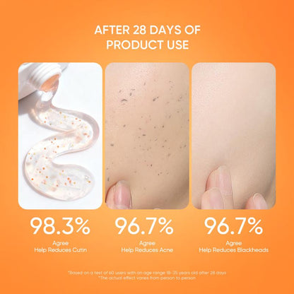 🔥Orange Enzyme ExfoliatingGel - The Gentle Miracle YourSkin Has Been Crying Out For